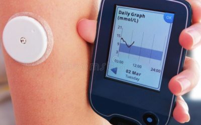 LA MESURE DU GLUCOSE EN CONTINU (CGM) EST EFFICIENTE DANS LE DT1 : UNE ÉTUDE COÛT/EFFICACITÉ